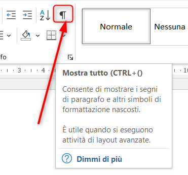 Tasto Mostra tutto